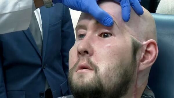 Primer trasplante de ojo completo del mundo es un éxito | 1000 Noticias