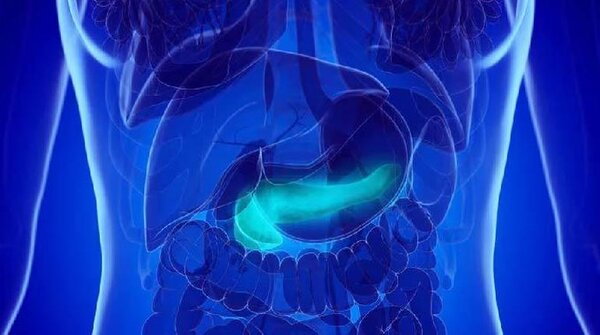 La ciencia reveló conexiones entre obesidad, diabetes y riesgo de cáncer de páncreas