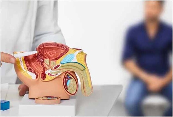 Fundación Tesãi alerta sobre síntomas del cáncer de próstata | DIARIO PRIMERA PLANA