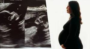 ¿Gemelos? ¿Mellizos? Mujer tiene un embarazo que es “una locura” y pone en jaque a tocólogos