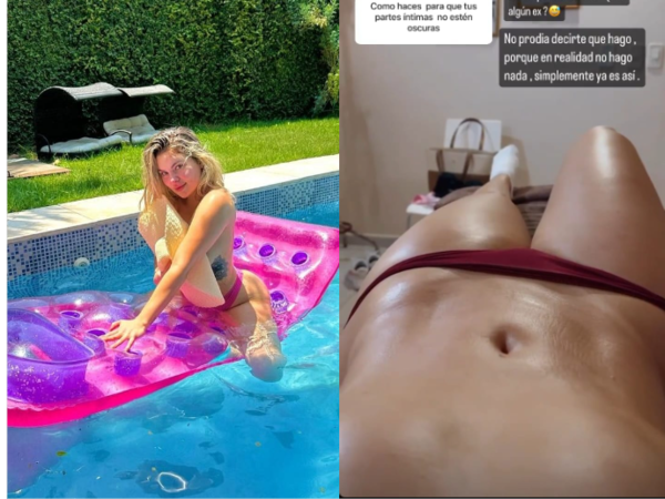 ¡Le preguntaron en redes por marcas en zonas íntimas y pensó que fue un ex!