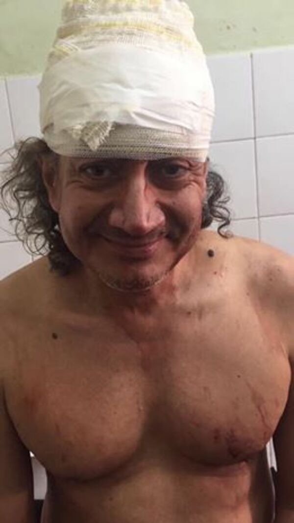 Rolando Chaparro atacado por «Drone asesino»