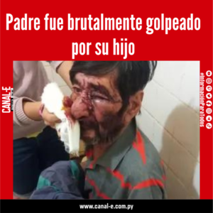Padre fue brutalmente golpeado por su hijo