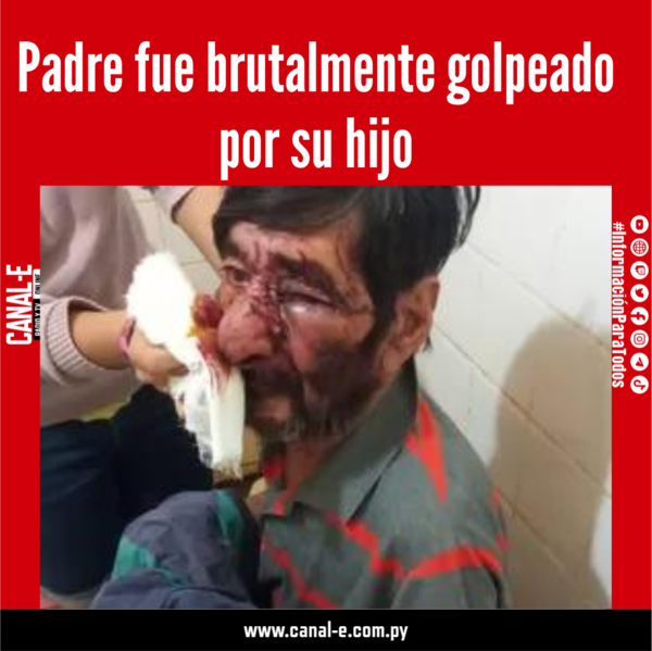 Padre fue brutalmente golpeado por su hijo