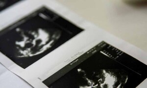 Mujer con útero doble queda embarazada en ambos: un caso extremadamente raro – Prensa 5