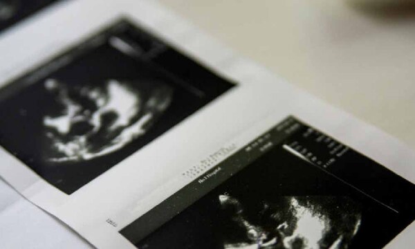 Mujer con útero doble queda embarazada en ambos: un caso extremadamente raro – Prensa 5