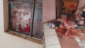 Joven de 23 años resultó con heridas de gravedad tras romper una ventana de vidrio - Oasis FM 94.3