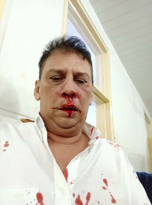Periodista de Concepcion fue agredido y acusa al senador Édgar López
