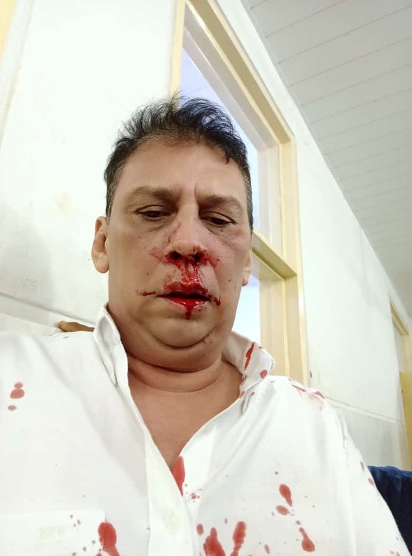 Periodista de Concepcion fue agredido y acusa al senador Édgar López