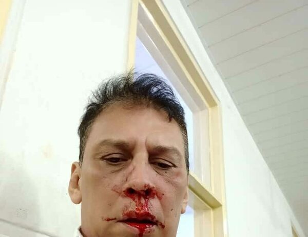 ¿Periodista fue agredido por orden de un senador hovy?