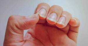 La Nación / ¿Tenés uñas quebradizas? Esta es la vitamina para fortalecerlas