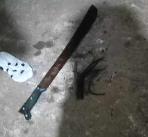 Investigan intento de feminicidio en San Lorenzo