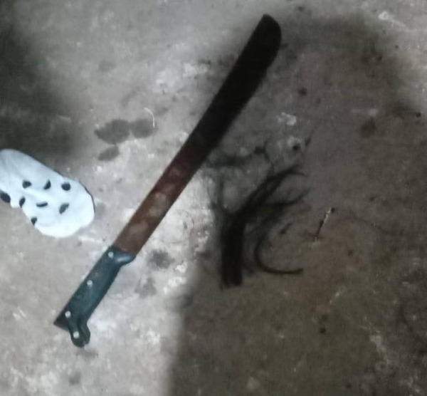 Investigan intento de feminicidio en San Lorenzo