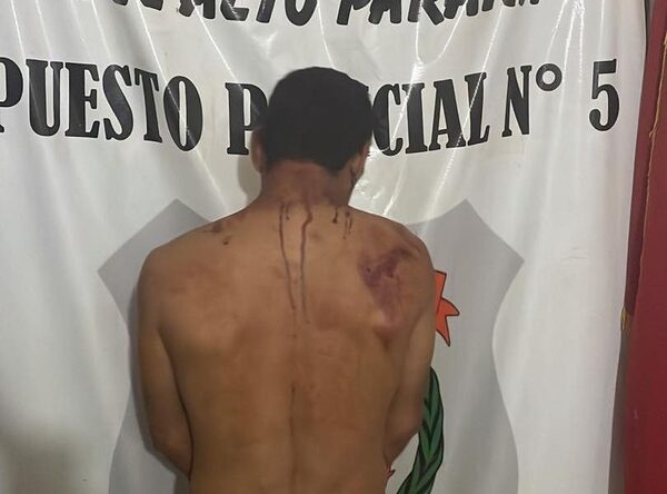 Un hombre golpeó a su pareja, la amenazó con matarla y escapó llevando a su hijo – Diario TNPRESS