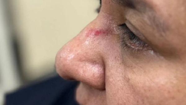 Inacción fiscal ante denuncia de agresión de un sujeto a una mujer - Noticias Paraguay