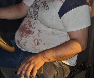 Brutal agresión a policía