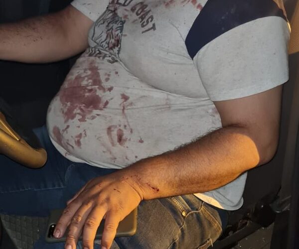 Brutal agresión a policía