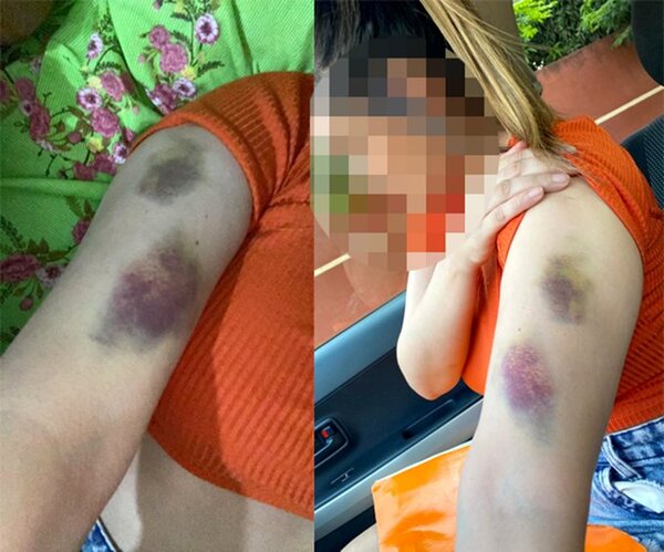 Agente policial golpeó a su expareja por negarse a mantener relaciones