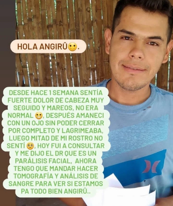 El influencer y cocinero Guido Penayo, comentó en sus redes sociales que tuvo una parálisis facial