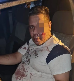 CDE: motociclistas golpearon brutalmente a un policía