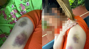 Policía golpeó y amenazó de muerte de su expareja - Noticiero Paraguay