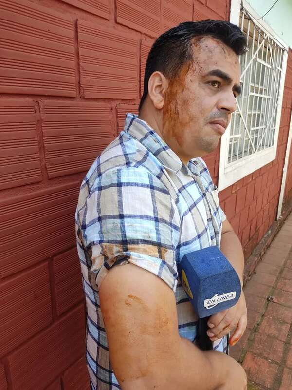 Turba leal a intendente de Jesús agrede a periodista durante allanamiento - Nacionales - ABC Color