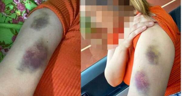 La Nación / Investigan a policía por brutal golpiza a su expareja