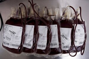 Covid-19: Uso de plasma reduce hasta en un 38% el riesgo de internación en UTI