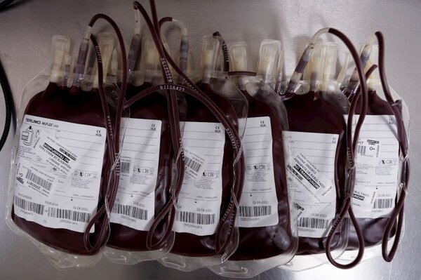 Covid-19: Uso de plasma reduce hasta en un 38% el riesgo de internación en UTI