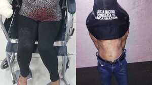Mujer atacada brutalmente por su concubino en Encarnación: detenido y arma blanca incautada