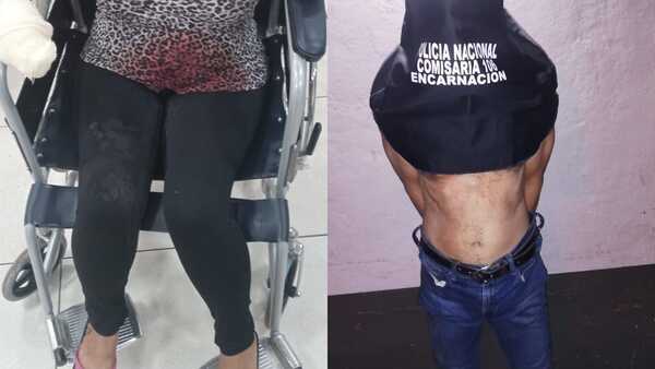 Mujer atacada brutalmente por su concubino en Encarnación: detenido y arma blanca incautada