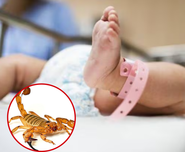 Beba en terapia intensiva tras picadura de alacrán