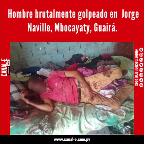 Hombre brutalmente golpeado en Jorge Naville, Mbocayaty, Guairá.