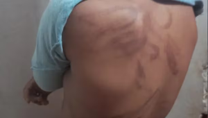 Niño de 11 años fue brutalmente golpeado por su mamá - Noticiero Paraguay