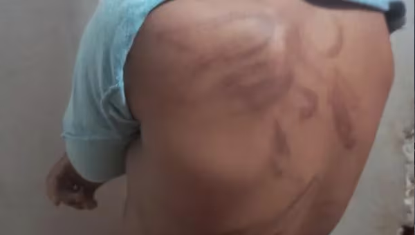 Niño de 11 años fue brutalmente golpeado por su mamá - Noticiero Paraguay