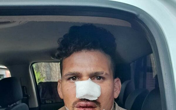 Por celos macheteó al nuevo novio de su ex