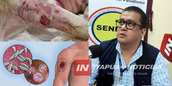 CASOS POSITIVOS DE LEISHMANIASIS NO HAN AUMENTADO RESPECTO AL AÑO ANTERIOR - Itapúa Noticias