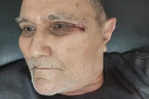 Karai fue herido en un asalto en Presidente Franco