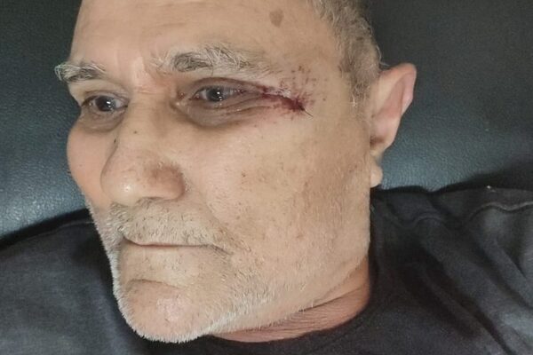 Karai fue herido en un asalto en Presidente Franco