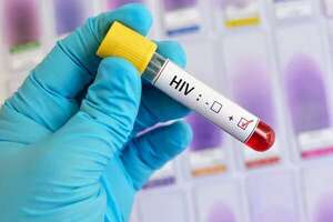 Alarmante: Pronasida reporta más de 1.300 nuevos casos de VIH - Nacionales - ABC Color