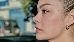 Larissa se niega a hacerse la "macanada" por sus labios