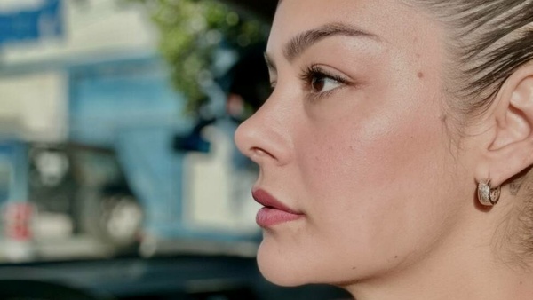 Larissa se niega a hacerse la "macanada" por sus labios