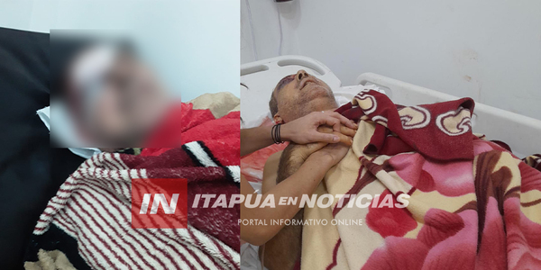 HOMBRE BALEADO TRAS ROBO EN ENCARNACIÓN SE ENCUENTRA EN TERAPIA INTENSIVA - Itapúa Noticias