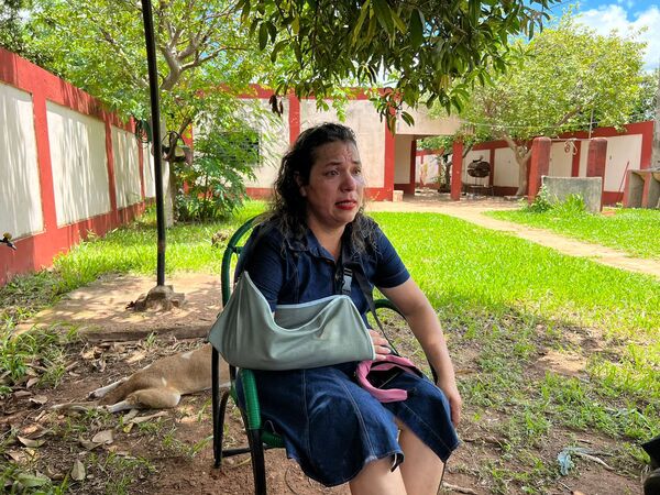 Fue brutalmente goleada por su ex esposo y ahora teme por su vida