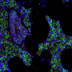 El coronavirus también puede infectar las células de la boca