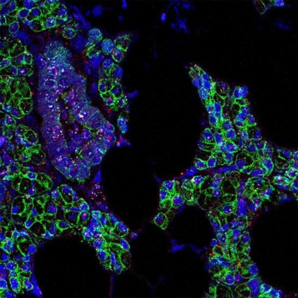 El coronavirus también puede infectar las células de la boca