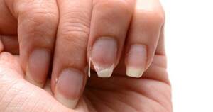 La Nación / ¿Por qué se quiebran o salen algunas marcas en las uñas?