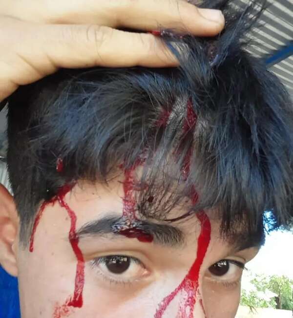Padre denuncia agresión contra su hijo e inacción policial - Policiales - ABC Color