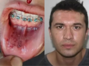 Túa denuncia agresión de un sujeto, como avei inacción y jeja’o de un karai comí “por meterse”