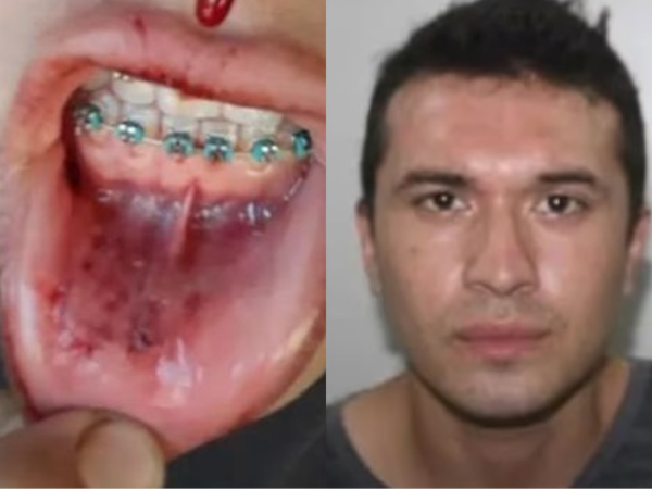 Túa denuncia agresión de un sujeto, como avei inacción y jeja’o de un karai comí “por meterse”